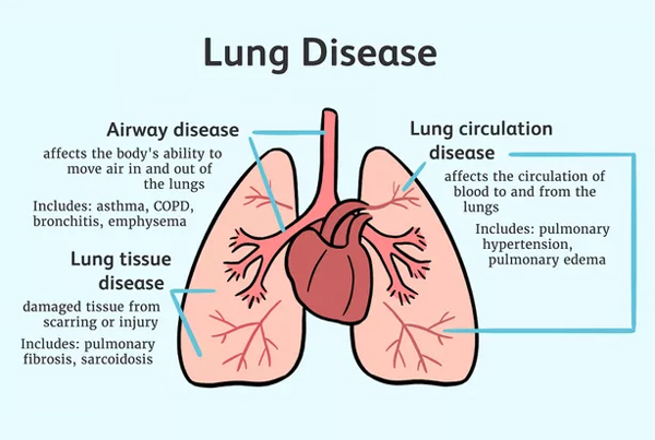 Chronic Lung Disease