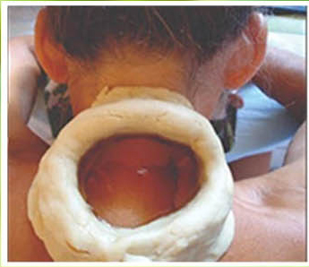 Best Ayurveda Treatment Centre